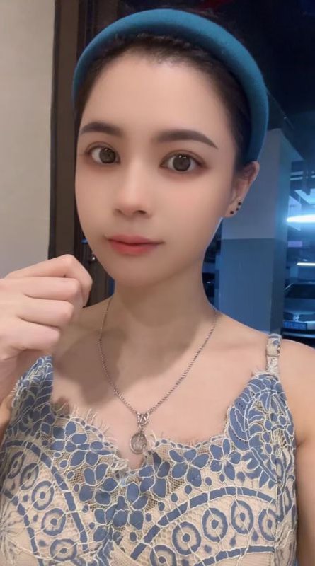 图片展示