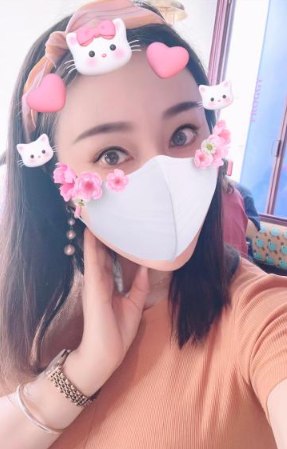 图片展示