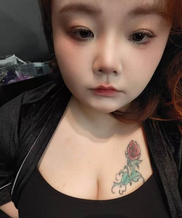 图片展示