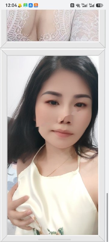 图片展示