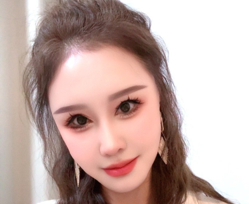 图片展示